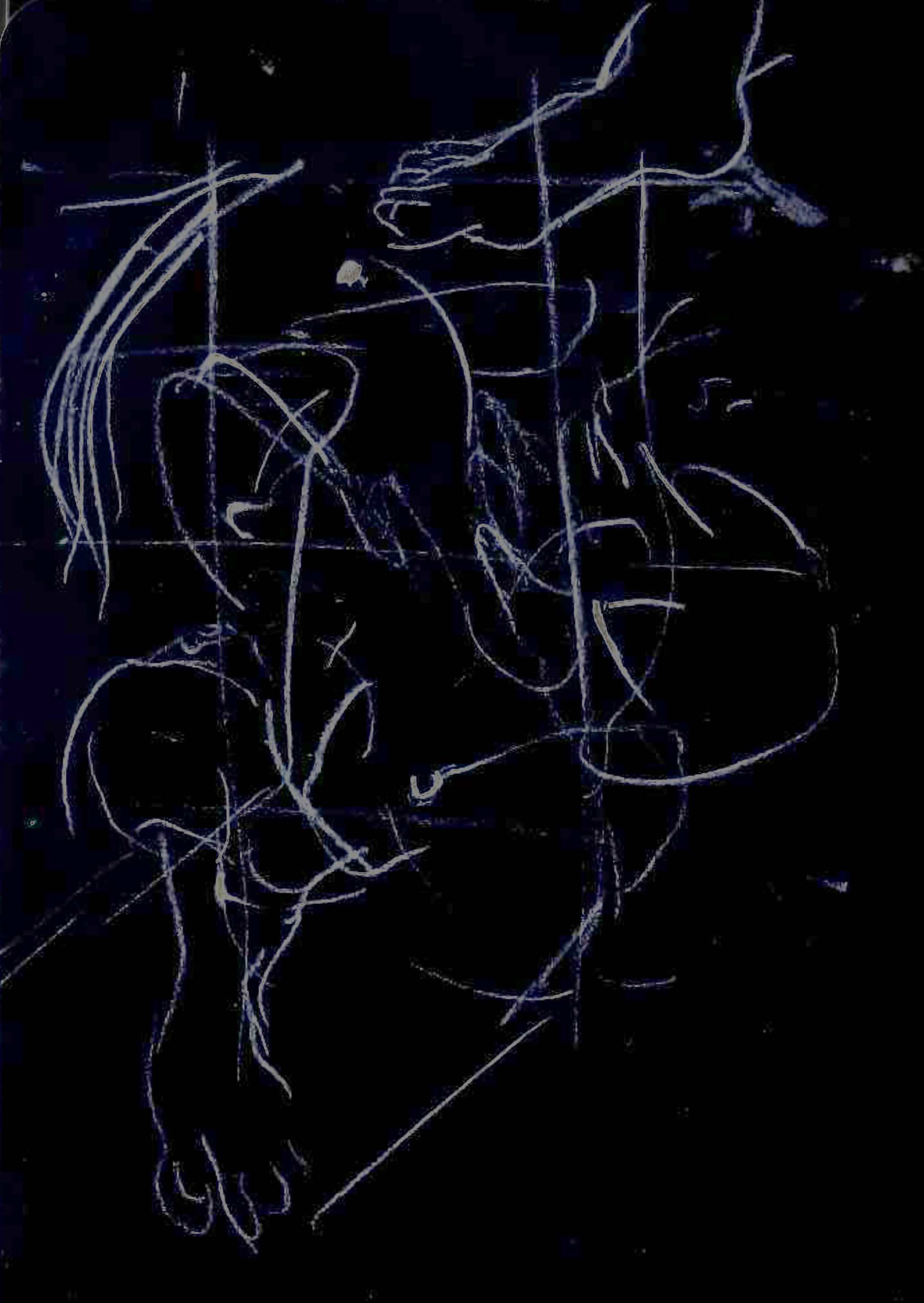 Skinner Releasing Technique